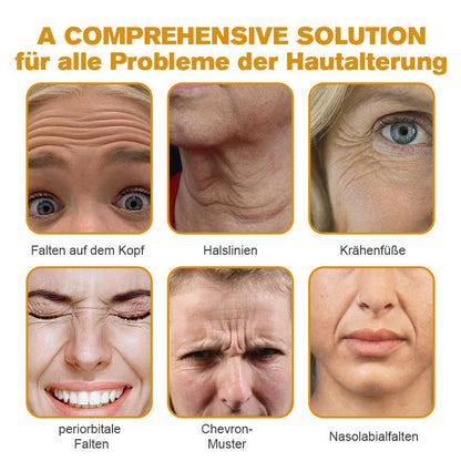🐝🐝𝐎𝐟𝐟𝐢𝐳𝐢𝐞𝐥𝐥𝐞𝐫 𝐒𝐭𝐨𝐫𝐞 | Letzter Tag der Aktion: 70 % Rabatt - ✨Furzero™ Botox Bienenvenom Faltenentfernungscreme