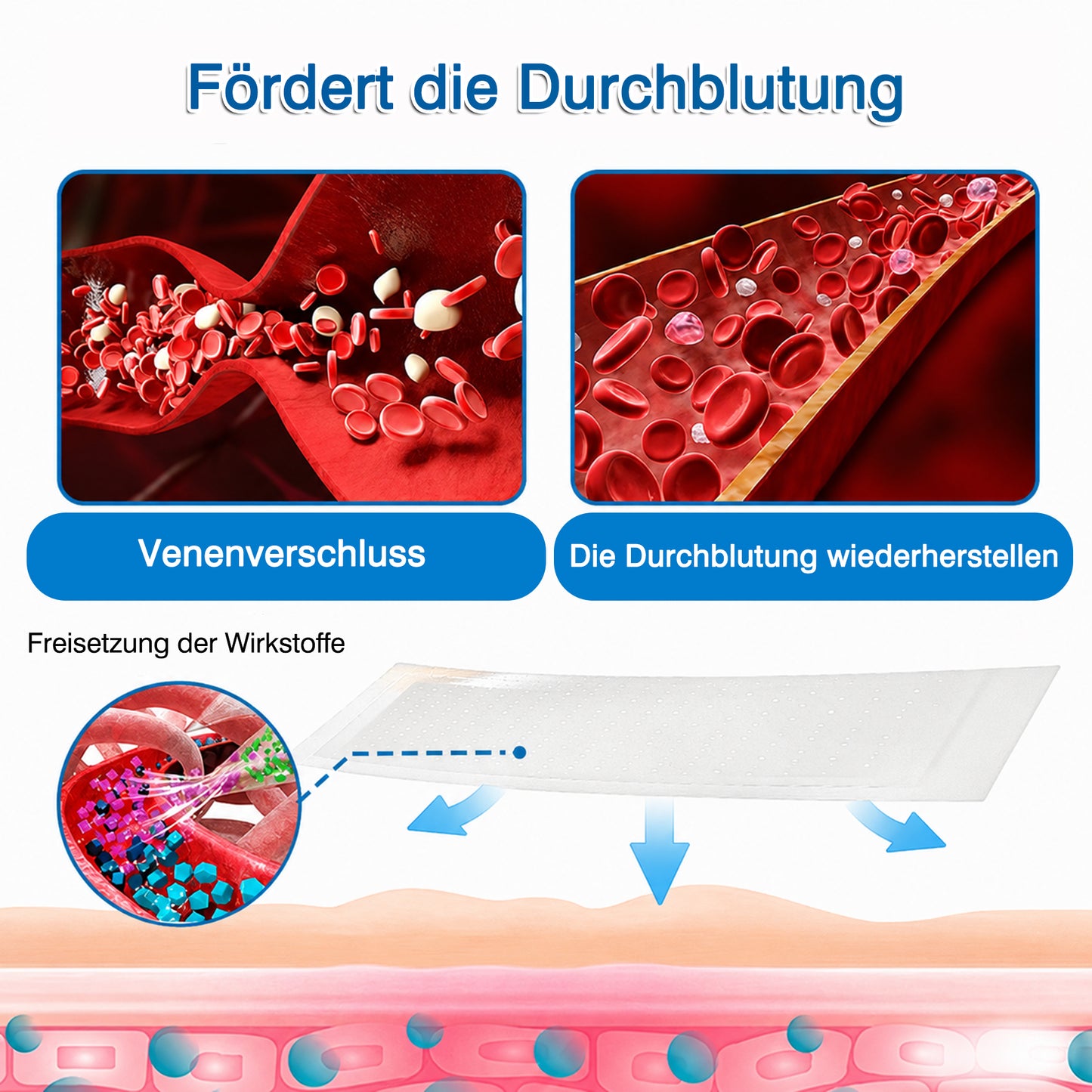 👨GFOUK® VeinRepair Mikronadel-Pflasterrolle ⚡ Sofortige Linderung, Langzeitergebnisse
