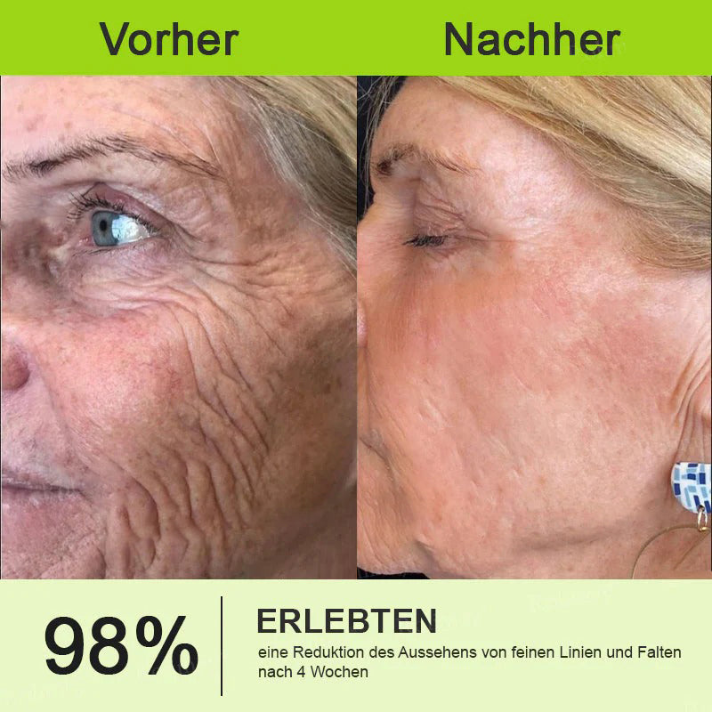 🇩🇪Jetzt jugendliche Haut zurückgewinnen💟Cvreoz® Botox & Vita-A Retinol Shot Falten-Lift Straffungscreme