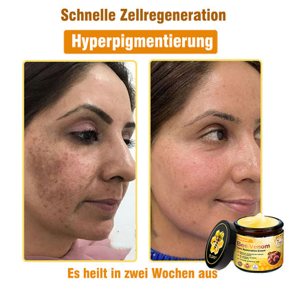🌟Hergestellt und versendet aus Deutschland💖  Ourlyard® Bienengift Hautregenerationscreme 🔥 LETZTER TAG 80 % RABATT 🌟