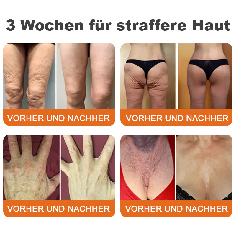 🇩🇪Hergestellt in Deutschland🍋‍🟩ROLIMEY® Botox-Bienenvergiftungsstraffungsserum-Stick🍃LETZTER TAG 70% RABATT