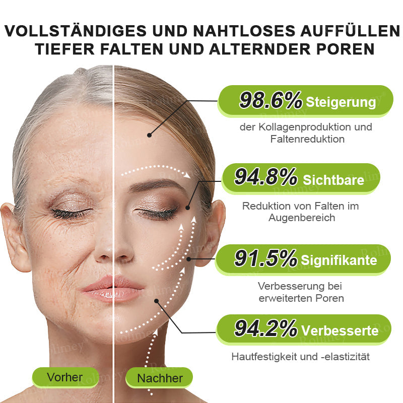 ✅Jetzt jugendliche Haut zurückgewinnen 💫Rolimey® Botox & Vita-A Retinol Shot Falten-Lift Straffungscreme