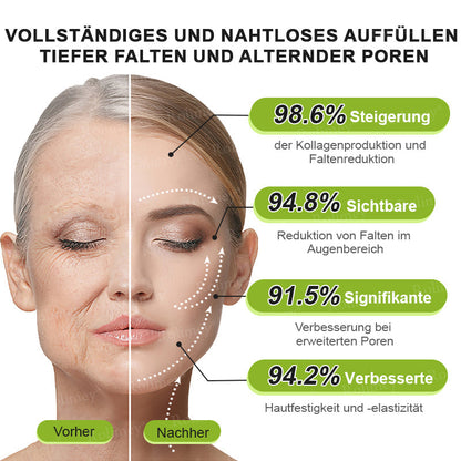 ✅Jetzt jugendliche Haut zurückgewinnen 💫Rolimey® Botox & Vita-A Retinol Shot Falten-Lift Straffungscreme