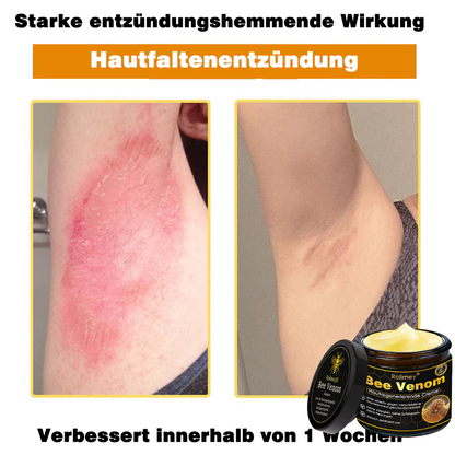 🎁🎁Neuestes Modell: Rolimey® Bienengift Max Pflegecreme – Reparatureffekt um 65 % gesteigert 🔥 NUR NOCH 80 % RABATT