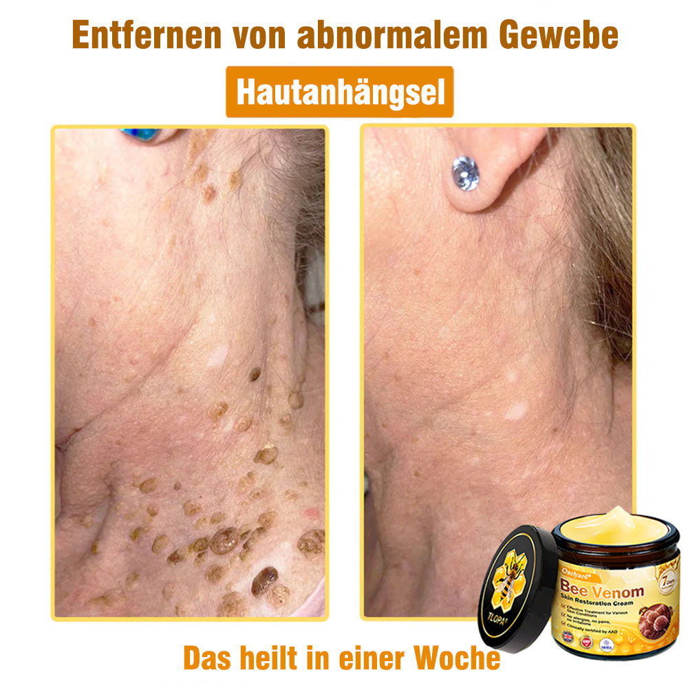 🌟Hergestellt und versendet aus Deutschland💖  Ourlyard® Bienengift Hautregenerationscreme 🔥 LETZTER TAG 80 % RABATT 🌟