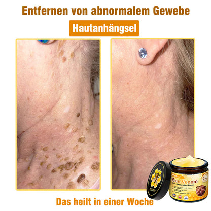 🌟Hergestellt und versendet aus Deutschland💖  Ourlyard® Bienengift Hautregenerationscreme 🔥 LETZTER TAG 80 % RABATT 🌟