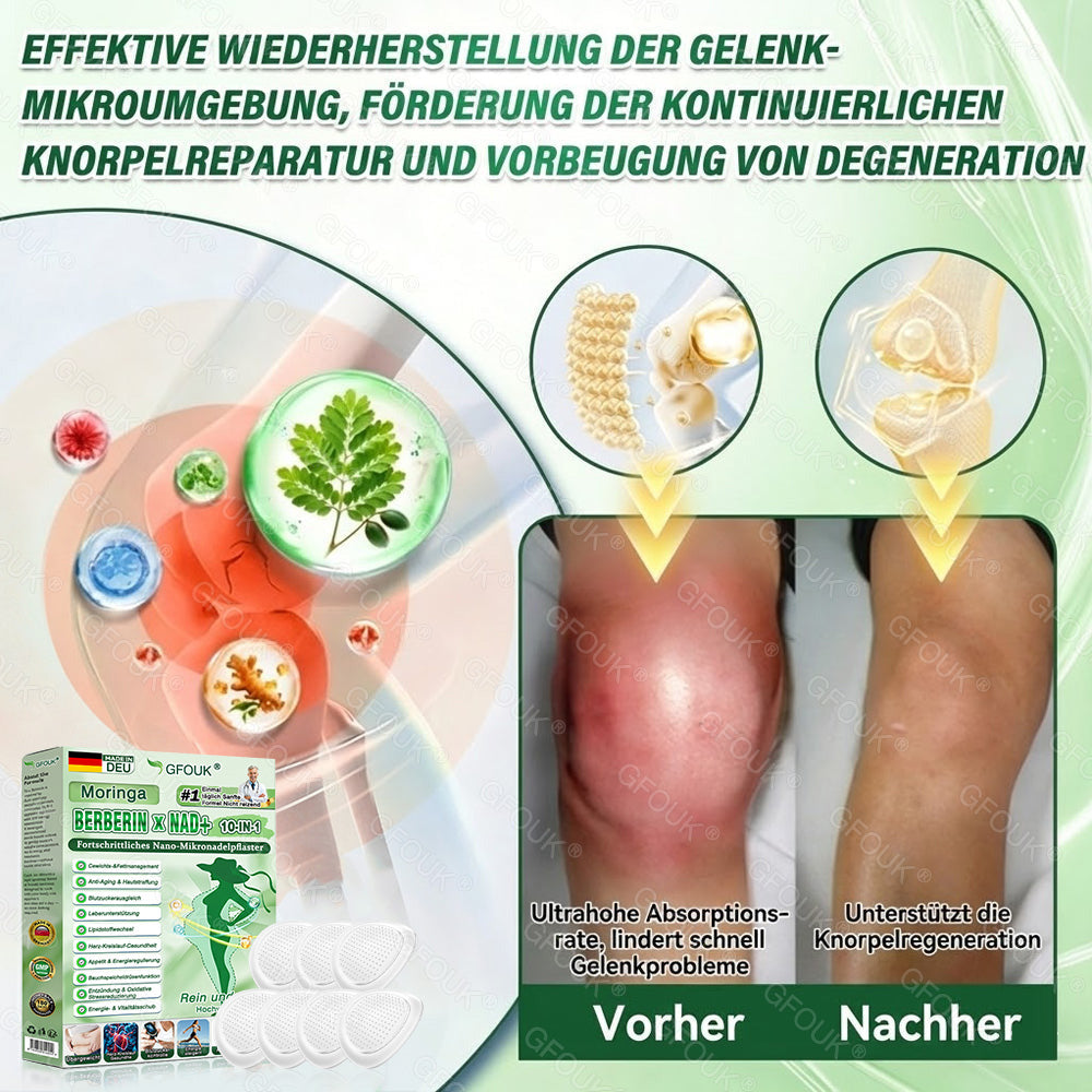 🇩🇪𝗢𝗳𝗳𝗶𝘇𝗶𝗲𝗹𝗹𝗲𝗿 𝗦𝗵𝗼𝗽 🏆| 🎁 𝗚𝗙𝗢𝗨𝗞® 𝗠𝗼𝗿𝗶𝗻𝗴𝗮 𝗕𝗲𝗿𝗯𝗲𝗿𝗶𝗻𝗲𝘅 𝗡𝗔𝗗+ 𝟭𝟬-𝗶𝗻-𝟭 𝗡𝗮𝗻𝗼-𝗠𝗶𝗸𝗿𝗼𝗻𝗮𝗱𝗲𝗹-𝗣𝗮𝘁𝗰𝗵 (𝗡𝘂𝗿 𝗲𝗶𝗻𝗺𝗮𝗹 𝘁ä𝗴𝗹𝗶𝗰𝗵, 𝘀𝗶𝗰𝗵𝘁𝗯𝗮𝗿𝗲 𝗩𝗲𝗿ä𝗻𝗱𝗲𝗿𝘂𝗻𝗴𝗲𝗻 𝗶𝗻 𝟳 𝗧𝗮𝗴𝗲𝗻) ✅✅ 𝗙ü𝗿 Ü𝗯𝗲𝗿𝗴𝗲𝘄𝗶𝗰𝗵𝘁, 𝗹𝗼𝗰𝗸𝗲𝗿𝗲 𝗛𝗮𝘂𝘁, 𝗗𝗶𝗮𝗯𝗲𝘁𝗲𝘀, 𝗦𝗰𝗵𝗹𝗮𝗳𝗮𝗽𝗻𝗼𝗲, 𝗚𝗲𝗹𝗲𝗻𝗸𝗽𝗿𝗼𝗯𝗹𝗲𝗺𝗲 𝘂𝗻𝗱 𝗺𝗲𝗵𝗿