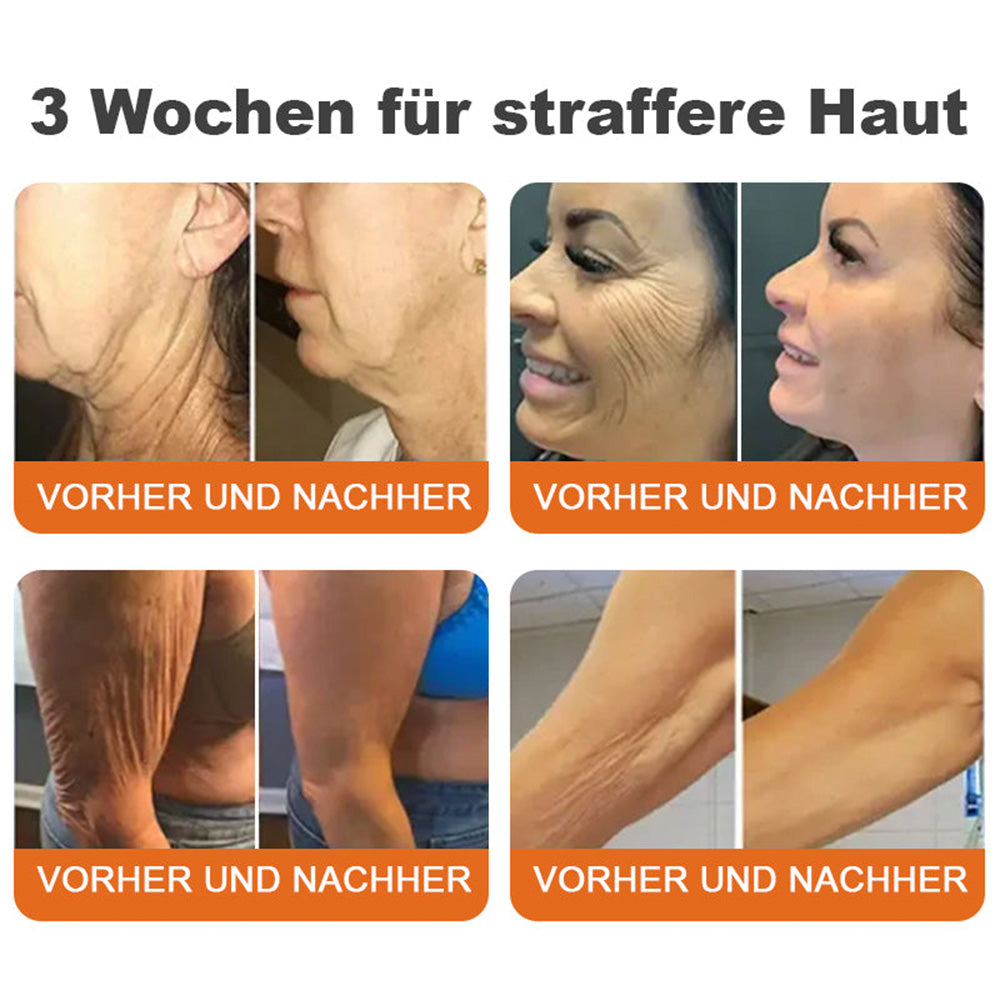 🇩🇪Hergestellt in Deutschland🍋‍🟩ROLIMEY® Botox-Bienenvergiftungsstraffungsserum-Stick🍃LETZTER TAG 70% RABATT