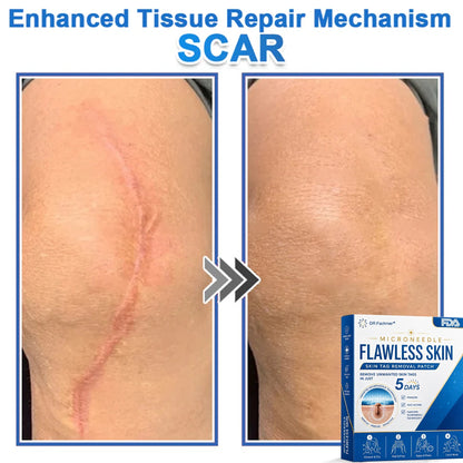 ✅ DR.Fachmer® 2-in-1 Microneedle & Hydrocolloid Patch | Raised Moles,Acne,  Flat Warts & Skin Tags Remover | Improves Wrinkles, Scars & Blemishes | Invisible Pimple Patches for Face & Body