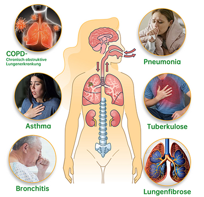 🍎Offizieller Shop|🔥Ourlyard™ Natürlicher Eukalyptus Lungenklar Inhalator 👨‍⚕️BfArM-certification(💝LETZTER TAG 50% RABATT 💝)