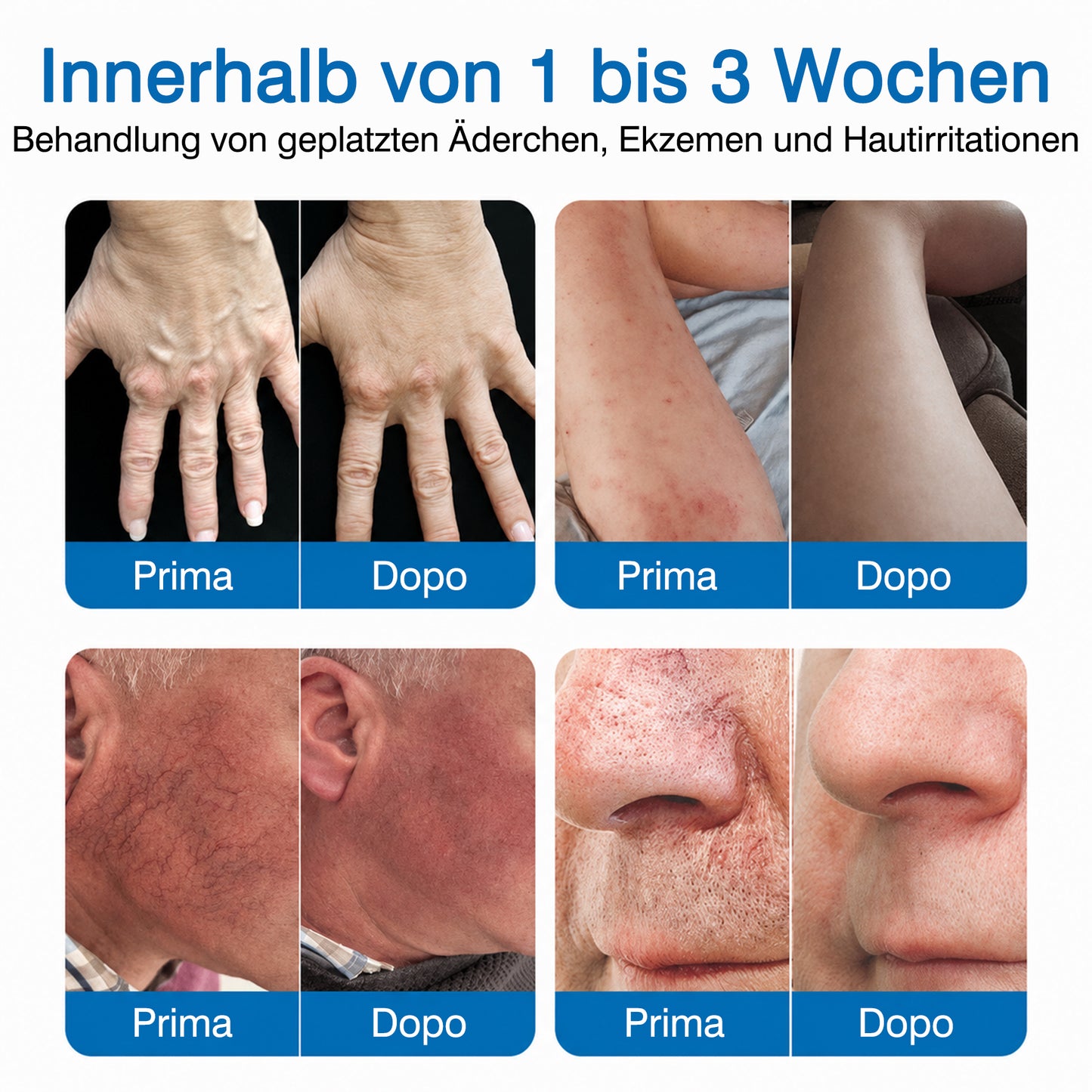 👨GFOUK® VeinRepair Mikronadel-Pflasterrolle ⚡ Sofortige Linderung, Langzeitergebnisse