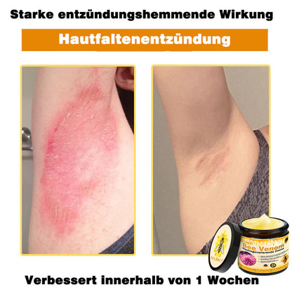 💎Rolimey® Bienengift Pro Umfassende Creme — 🔥Begrenzte Zeit 80 % RABATT🔥