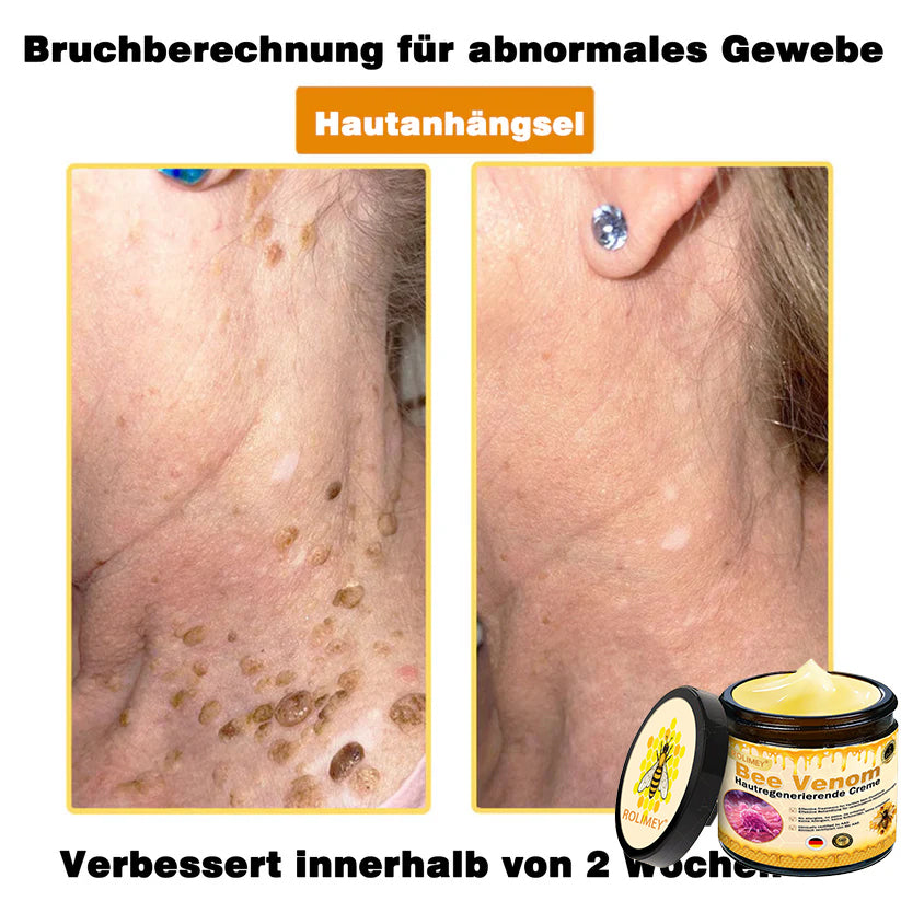 💎Rolimey® Bienengift Pro Umfassende Creme — 🔥Begrenzte Zeit 80 % RABATT🔥