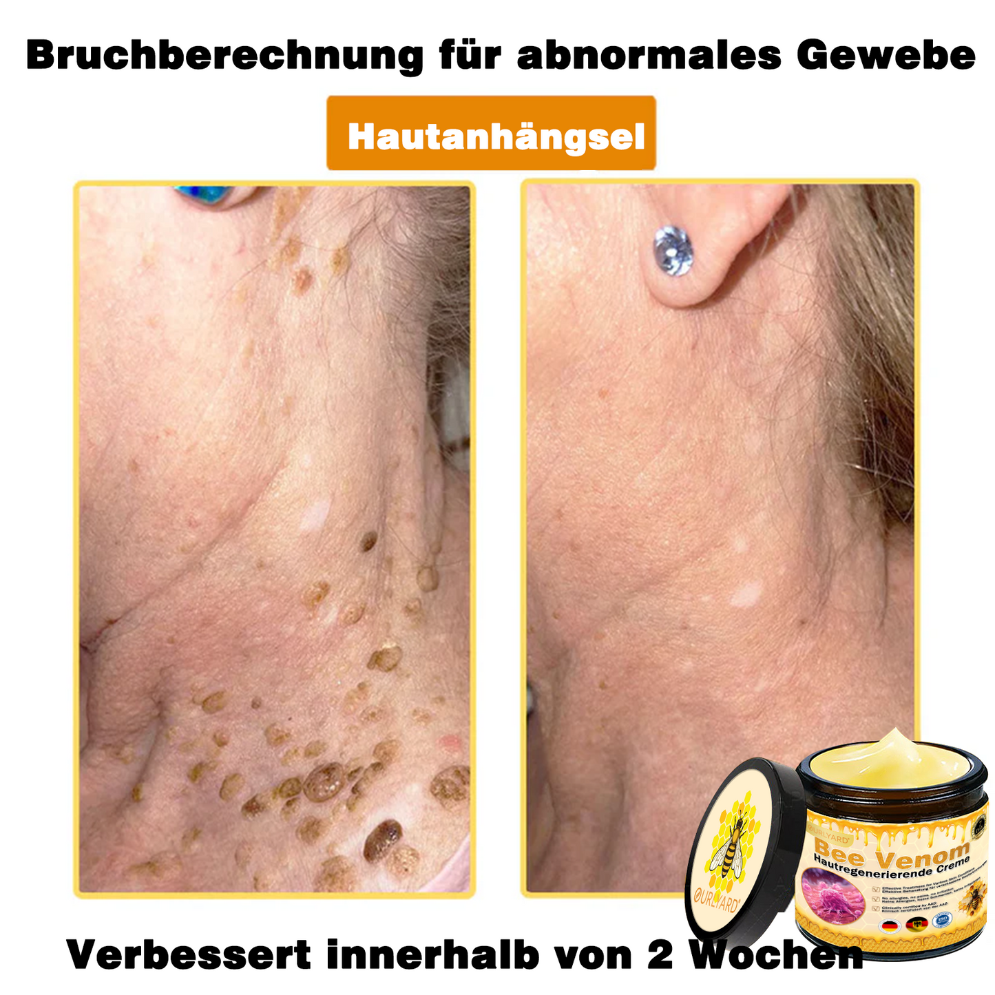 💥Ourlyard® Bienengift Pro Umfassende Creme — 💥Begrenzte Zeit 80 % RABATT💥