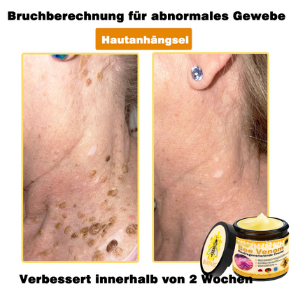 💥Ourlyard® Bienengift Pro Umfassende Creme — 💥Begrenzte Zeit 80 % RABATT💥
