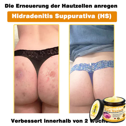 💎Rolimey® Bienengift Pro Umfassende Creme — 🔥Begrenzte Zeit 80 % RABATT🔥