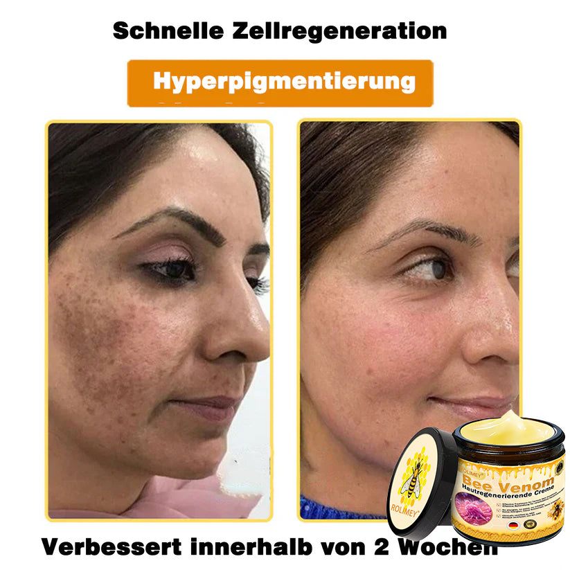 🔥Rolimey® Bienengift Pro Umfassende Creme — 🔥Begrenzte Zeit 80 % RABATT🔥