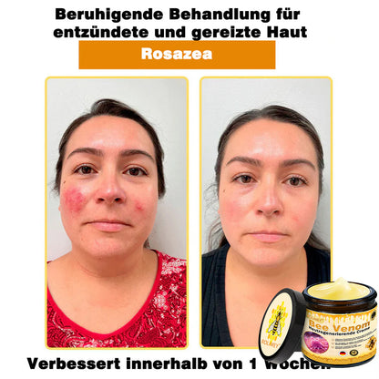 🔥Rolimey® Bienengift Pro Umfassende Creme — 🔥Begrenzte Zeit 80 % RABATT🔥
