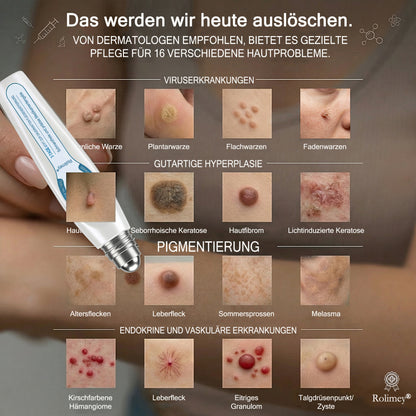❤️Genieße 30 % Rabatt beim Hinzufügen des zweiten Artikels