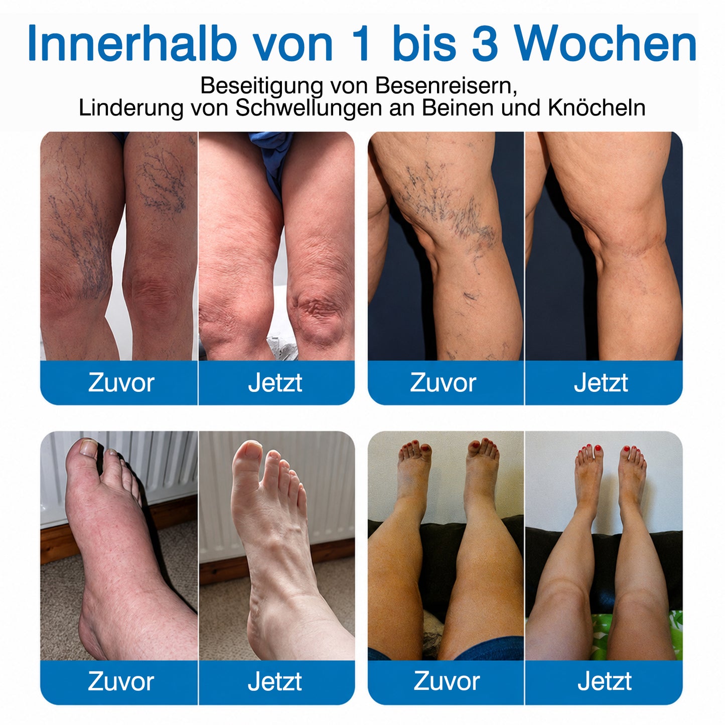 👨GFOUK® VeinRepair Mikronadel-Pflasterrolle ⚡ Sofortige Linderung, Langzeitergebnisse