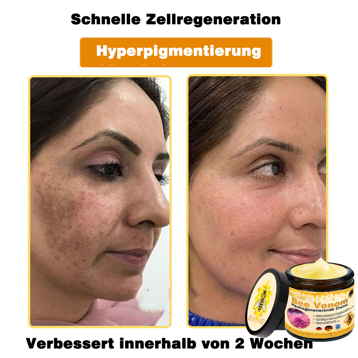 💥Ourlyard® Bienengift Pro Umfassende Creme — 💥Begrenzte Zeit 80 % RABATT💥