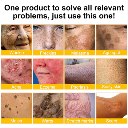 🌟Hergestellt und versendet aus Deutschland💖  Ourlyard® Bienengift Hautregenerationscreme 🔥 LETZTER TAG 80 % RABATT 🌟