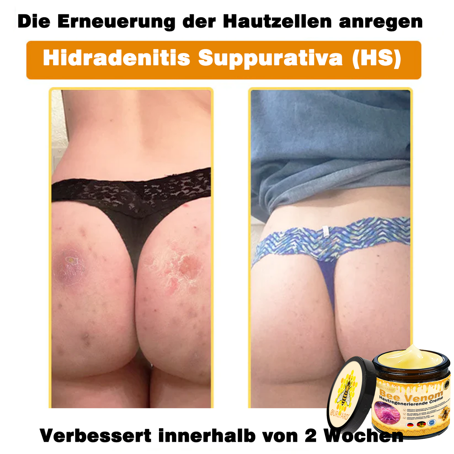 💥Ourlyard® Bienengift Pro Umfassende Creme — 💥Begrenzte Zeit 80 % RABATT💥