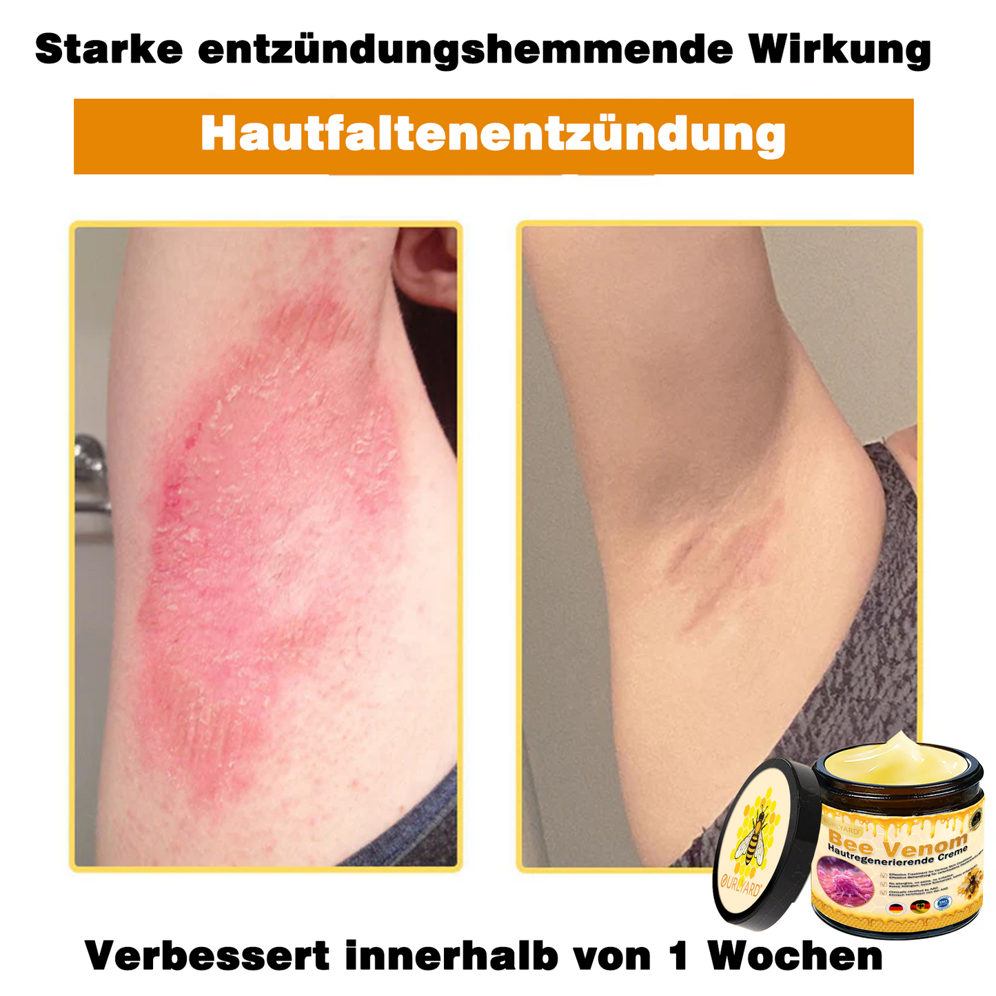 💥Ourlyard® Bienengift Pro Umfassende Creme — 💥Begrenzte Zeit 80 % RABATT💥