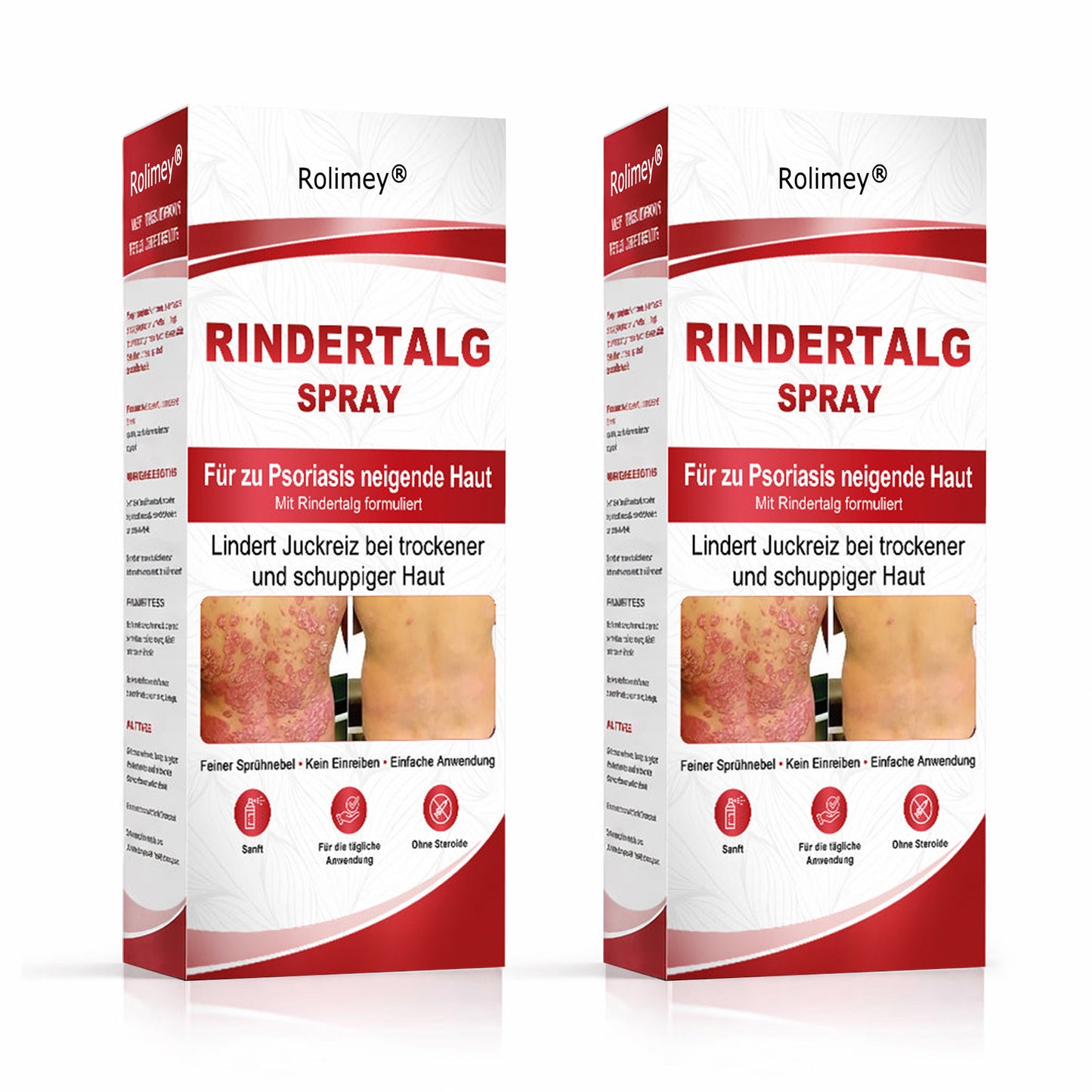 Rolimey® Rindertalg-Spray für juckende, schuppige Psoriasis-Haut 1