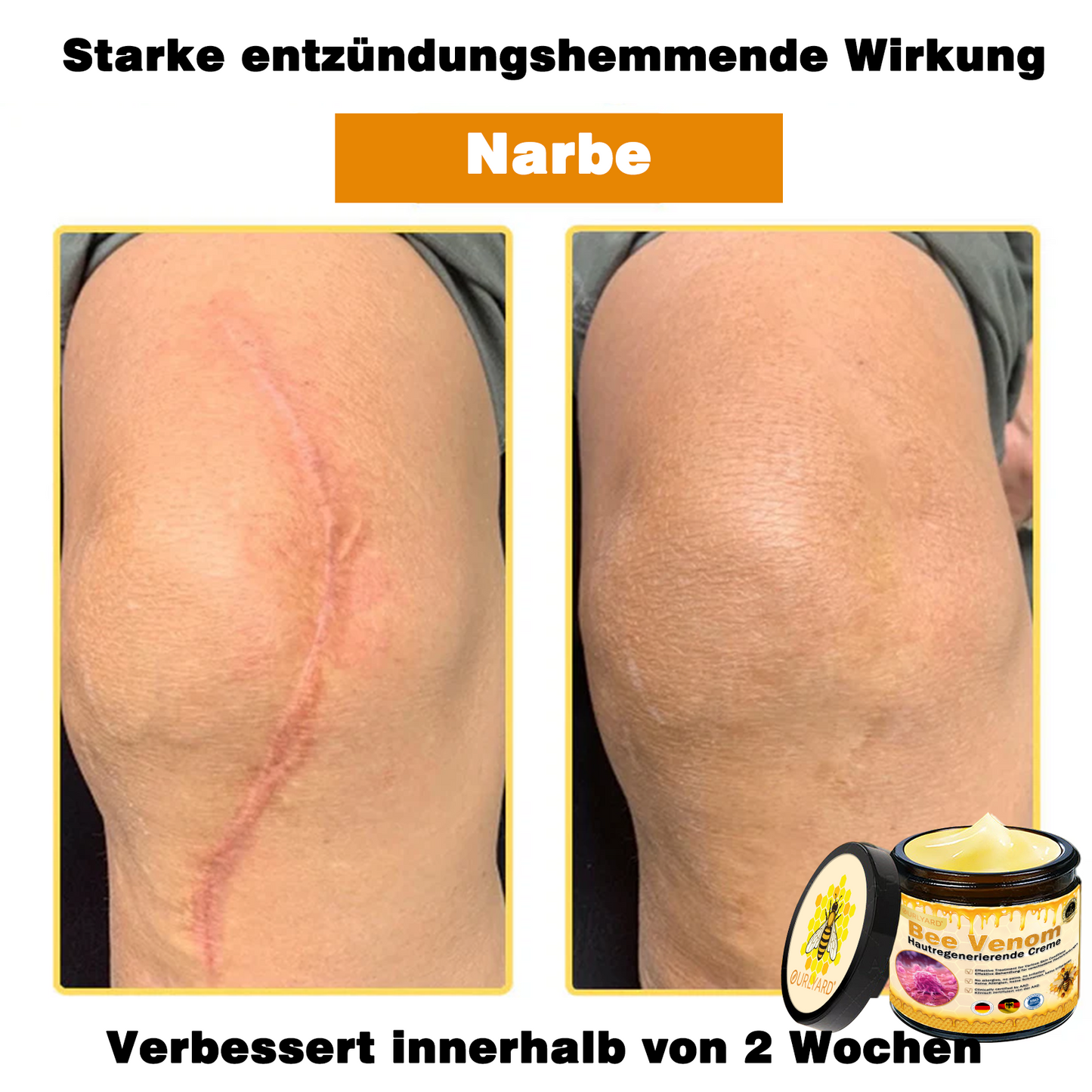 💥Ourlyard® Bienengift Pro Umfassende Creme — 💥Begrenzte Zeit 80 % RABATT💥