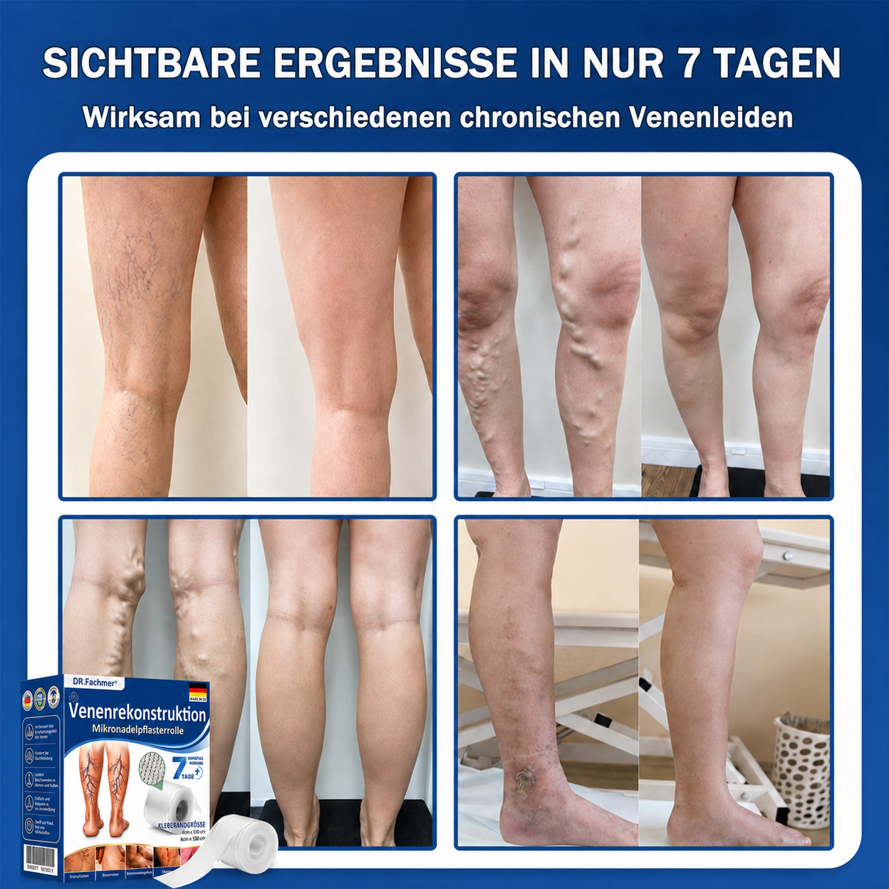 🏥DR.Fachmer® Mikronadel-Pflaster VeinRepair ⚡ Sofortige Entlastung & langfristige Ergebnisse für müde Beine
