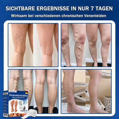 🏥DR.Fachmer® Mikronadel-Pflaster VeinRepair ⚡ Sofortige Entlastung & langfristige Ergebnisse für müde Beine