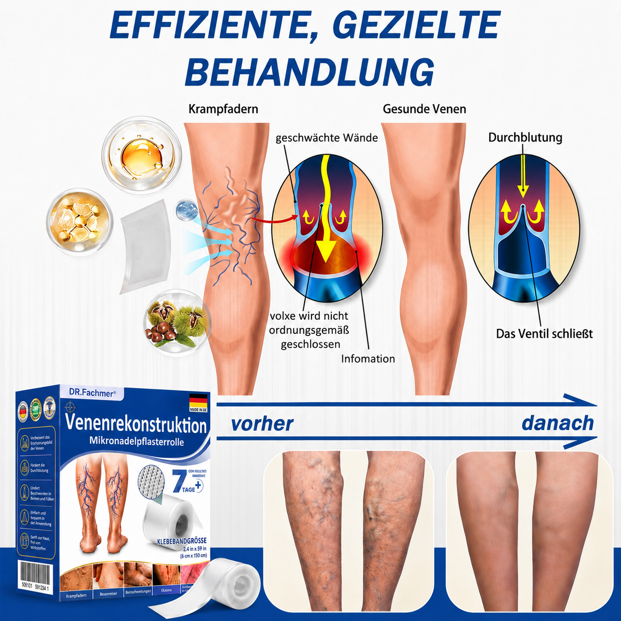 🏥DR.Fachmer® Mikronadel-Pflaster VeinRepair ⚡ Sofortige Entlastung & langfristige Ergebnisse für müde Beine