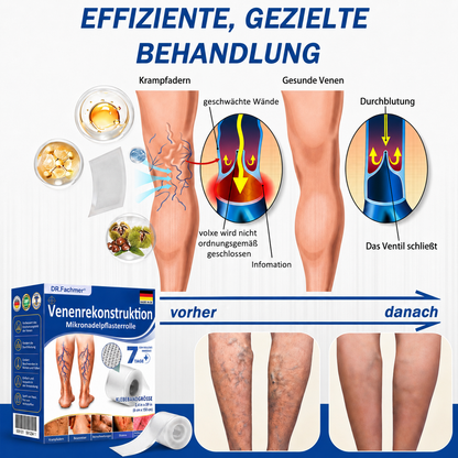 🏥DR.Fachmer® Mikronadel-Pflaster VeinRepair ⚡ Sofortige Entlastung & langfristige Ergebnisse für müde Beine