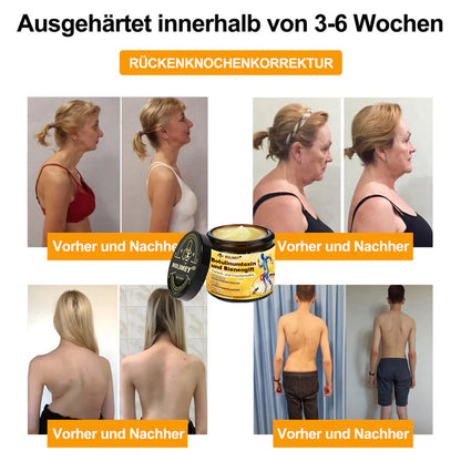 ✅ Offizieller Shop: Rolimey® Bienengift-Schmerzlinderungs Knochenheilungs Creme 👨‍⚕️(Reduzierung von Gelenkschwellungen, Schmerzen, Steifheit, Rötungen, Wärme, Muskelkater und Gelenkmüdigkeit)