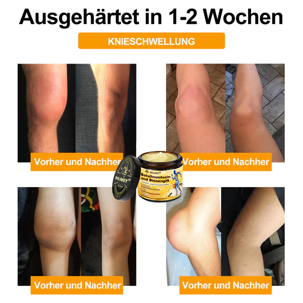 ✅ Offizieller Shop: Rolimey® Bienengift-Schmerzlinderungs Knochenheilungs Creme 👨‍⚕️(Reduzierung von Gelenkschwellungen, Schmerzen, Steifheit, Rötungen, Wärme, Muskelkater und Gelenkmüdigkeit)
