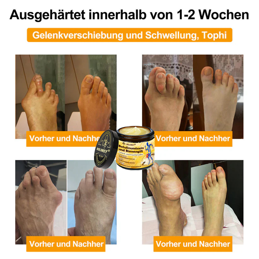 ✅ Offizieller Shop: Rolimey® Bienengift-Schmerzlinderungs Knochenheilungs Creme 👨‍⚕️(Reduzierung von Gelenkschwellungen, Schmerzen, Steifheit, Rötungen, Wärme, Muskelkater und Gelenkmüdigkeit)