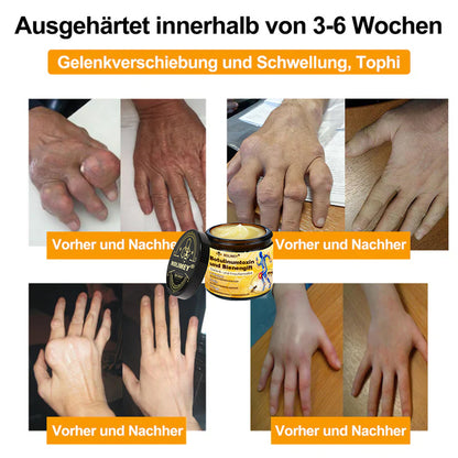 ✅ Offizieller Shop: Rolimey® Bienengift-Schmerzlinderungs Knochenheilungs Creme 👨‍⚕️(Reduzierung von Gelenkschwellungen, Schmerzen, Steifheit, Rötungen, Wärme, Muskelkater und Gelenkmüdigkeit)