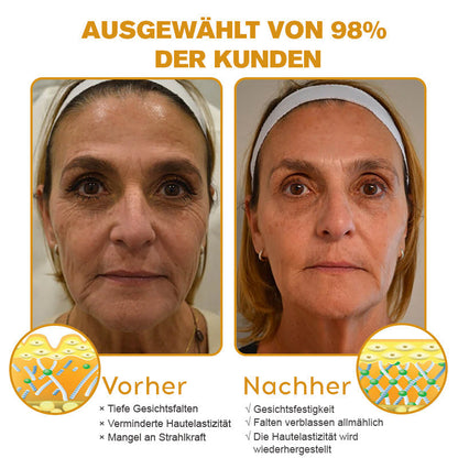 🏆Letzter Tag der Aktion: 70 % Rabatt - ✨Furzero™ Botox Bienenvenom Faltenentfernungscreme