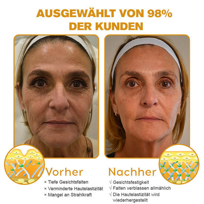 🐝🐝𝐎𝐟𝐟𝐢𝐳𝐢𝐞𝐥𝐥𝐞𝐫 𝐒𝐭𝐨𝐫𝐞 | Letzter Tag der Aktion: 70 % Rabatt - ✨Furzero™ Botox Bienenvenom Faltenentfernungscreme