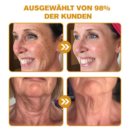 🌲𝐎𝐟𝐟𝐢𝐳𝐢𝐞𝐥𝐥𝐞𝐫 𝐒𝐭𝐨𝐫𝐞 | Letzter Tag der Aktion: 70 % Rabatt - 🌲Furzero™ Botox Bienenvenom Faltenentfernungscreme