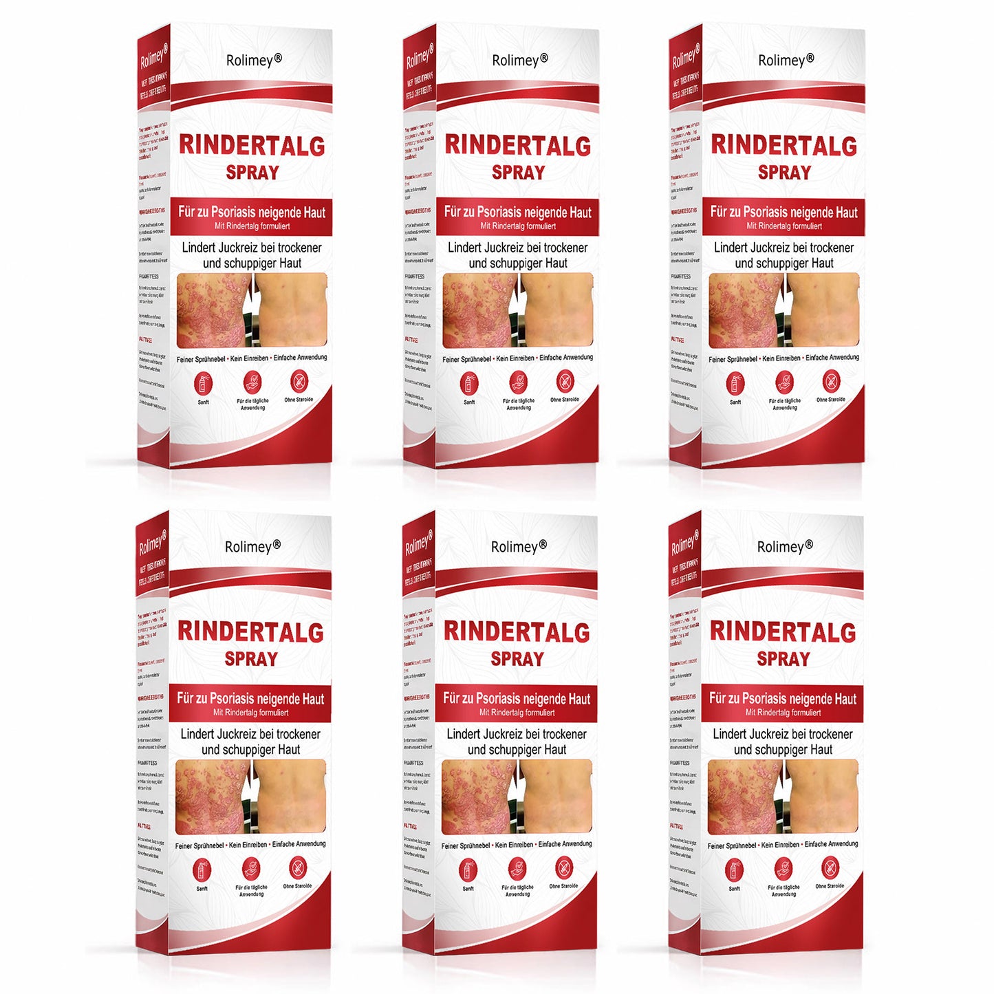 Rolimey® Rindertalg-Spray für juckende, schuppige Psoriasis-Haut 1