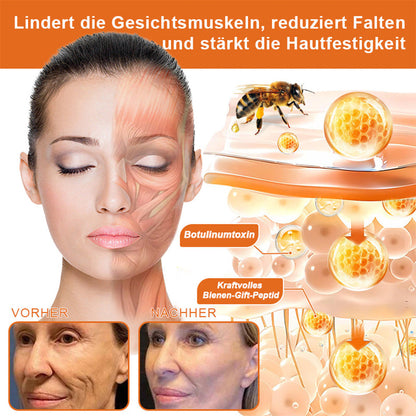 🇩🇪Hergestellt in Deutschland🍋‍🟩ROLIMEY® Botox-Bienenvergiftungsstraffungsserum-Stick🍃LETZTER TAG 70% RABATT