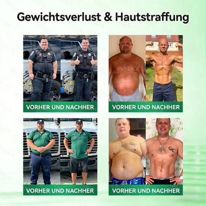 🍈🇩🇪𝗢𝗳𝗳𝗶𝘇𝗶𝗲𝗹𝗹𝗲𝗿 𝗦𝗵𝗼𝗽 | 🎁 𝗚𝗙𝗢𝗨𝗞® 𝗠𝗼𝗿𝗶𝗻𝗴𝗮 𝗕𝗲𝗿𝗯𝗲𝗿𝗶𝗻𝗲𝘅 𝗡𝗔𝗗+ 𝟭𝟬-𝗶𝗻-𝟭 𝗡𝗮𝗻𝗼-𝗠𝗶𝗸𝗿𝗼𝗻𝗮𝗱𝗲𝗹-𝗣𝗮𝘁𝗰𝗵 (𝗡𝘂𝗿 𝗲𝗶𝗻𝗺𝗮𝗹 𝘁ä𝗴𝗹𝗶𝗰𝗵, 𝘀𝗶𝗰𝗵𝘁𝗯𝗮𝗿𝗲 𝗩𝗲𝗿ä𝗻𝗱𝗲𝗿𝘂𝗻𝗴𝗲𝗻 𝗶𝗻 𝟳 𝗧𝗮𝗴𝗲𝗻) ✅ 𝗙ü𝗿 Ü𝗯𝗲𝗿𝗴𝗲𝘄𝗶𝗰𝗵𝘁, 𝗹𝗼𝗰𝗸𝗲𝗿𝗲 𝗛𝗮𝘂𝘁, 𝗗𝗶𝗮𝗯𝗲𝘁𝗲𝘀, 𝗦𝗰𝗵𝗹𝗮𝗳𝗮𝗽𝗻𝗼𝗲, 𝗚𝗲𝗹𝗲𝗻𝗸𝗽𝗿𝗼𝗯𝗹𝗲𝗺𝗲 𝘂𝗻𝗱 𝗺𝗲𝗵𝗿