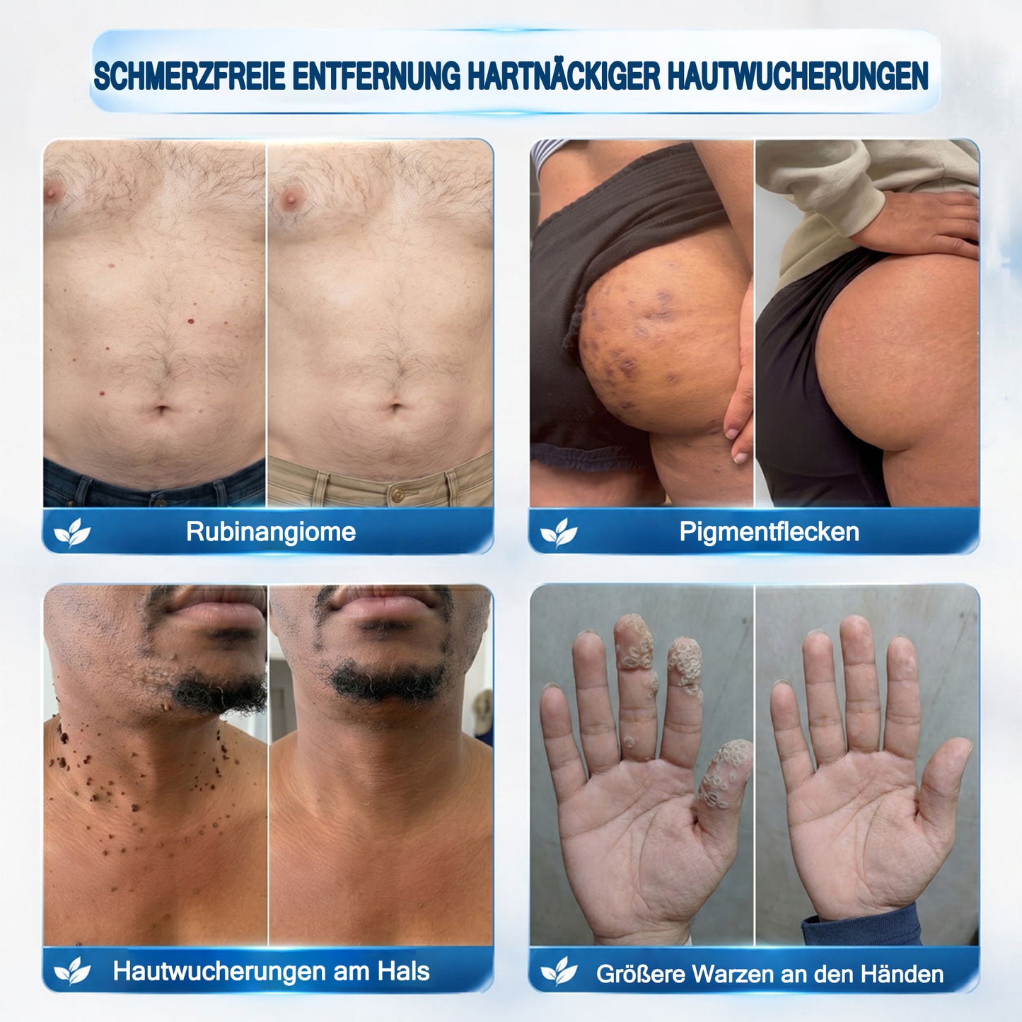 ❤️Genieße 30 % Rabatt beim Hinzufügen des zweiten Artikels