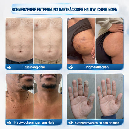 ❤️Genieße 30 % Rabatt beim Hinzufügen des zweiten Artikels