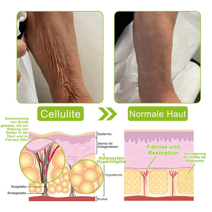 ✅Dr. Fachmer®👩‍⚕️ Peptid-Kollagen-Pflege für sofortige Straffung ⏰& Festigung – glättet augenblicklich Schwellungen und Fältchen und fördert bei regelmäßiger Anwendung eine straffere Haut.