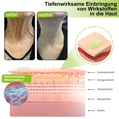 ✅Dr. Fachmer®👩‍⚕️ Peptid-Kollagen-Pflege für sofortige Straffung ⏰& Festigung – glättet augenblicklich Schwellungen und Fältchen und fördert bei regelmäßiger Anwendung eine straffere Haut.