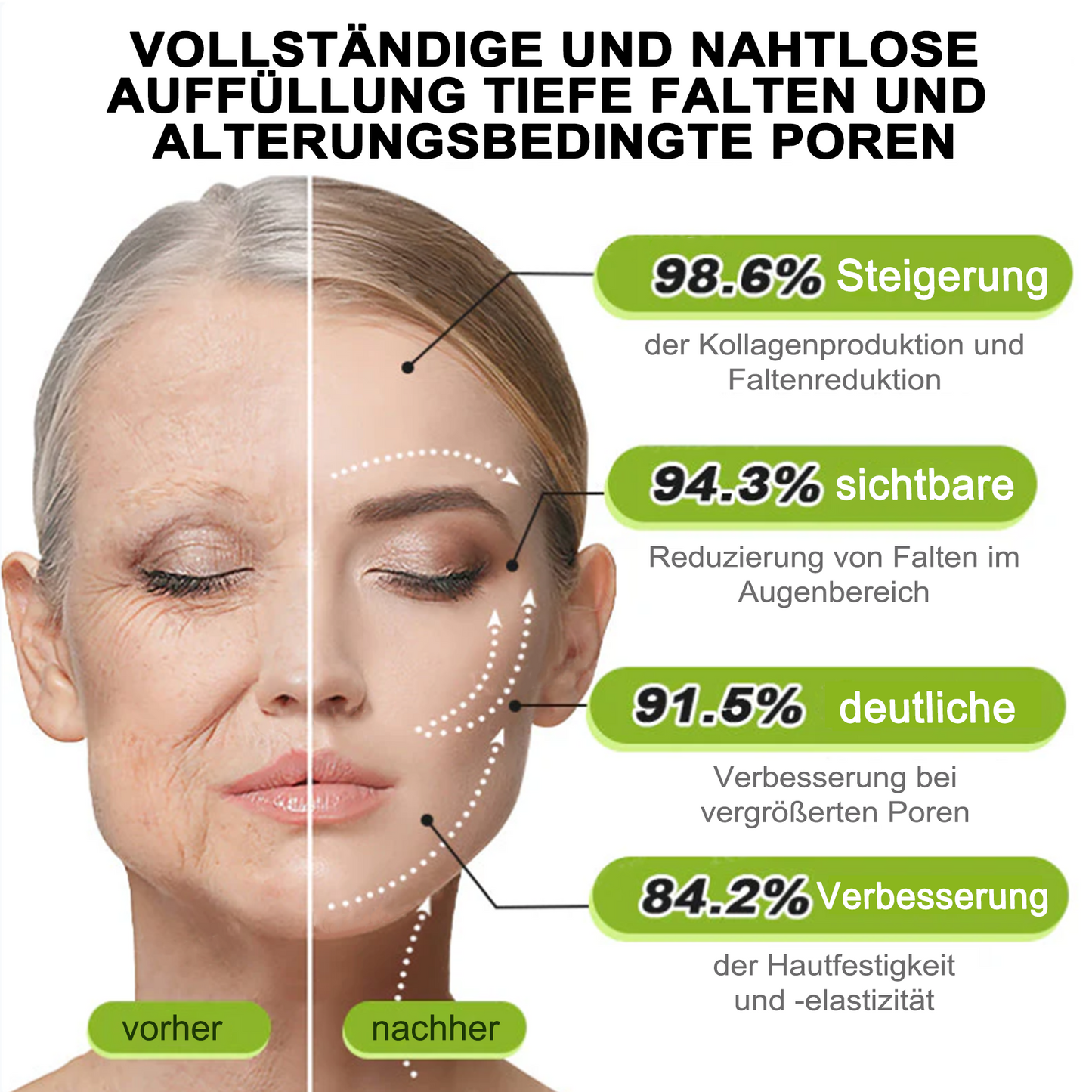 ✅Dr. Fachmer®👩‍⚕️ Peptid-Kollagen-Pflege für sofortige Straffung ⏰& Festigung – glättet augenblicklich Schwellungen und Fältchen und fördert bei regelmäßiger Anwendung eine straffere Haut.