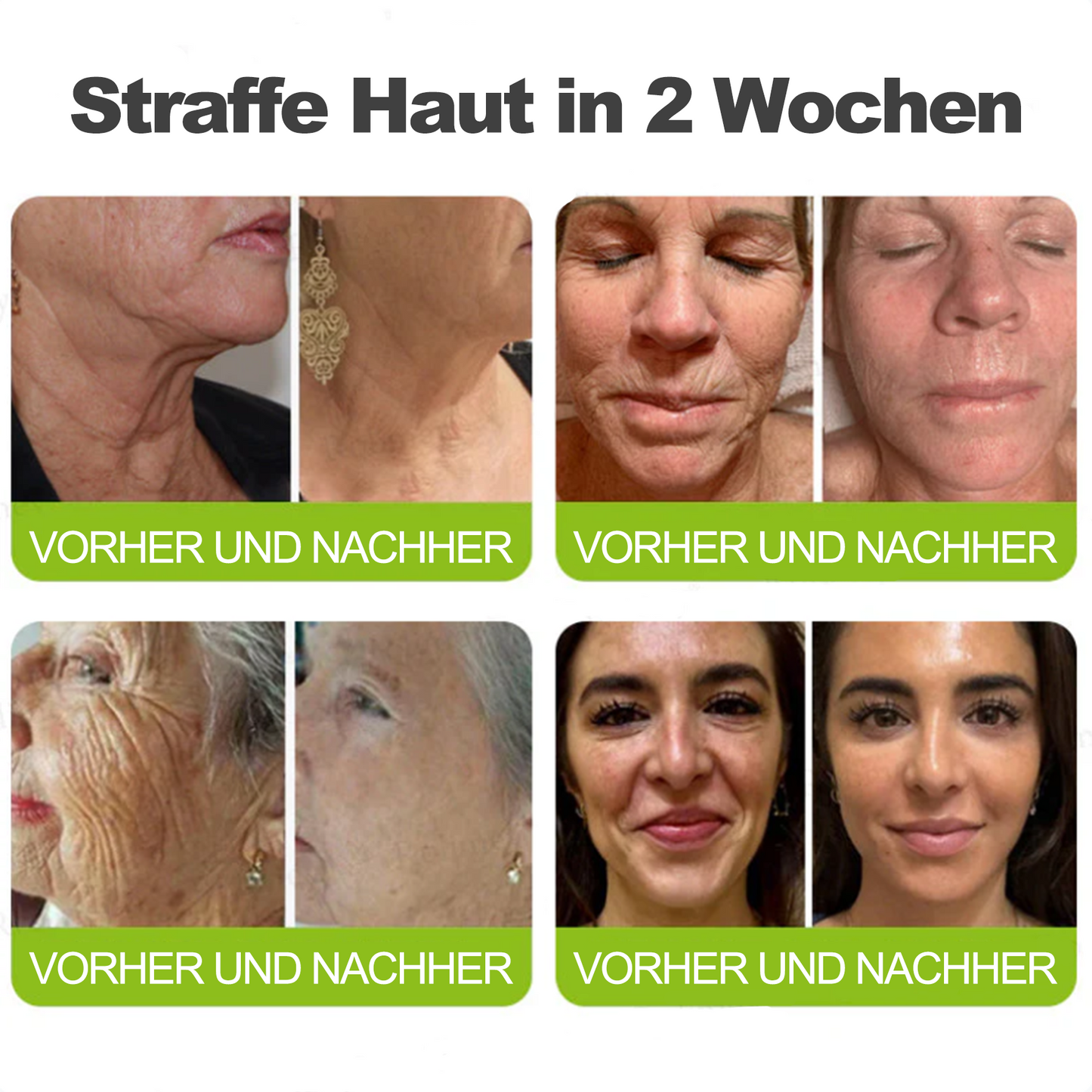 ✅Dr. Fachmer®👩‍⚕️ Peptid-Kollagen-Pflege für sofortige Straffung ⏰& Festigung – glättet augenblicklich Schwellungen und Fältchen und fördert bei regelmäßiger Anwendung eine straffere Haut.
